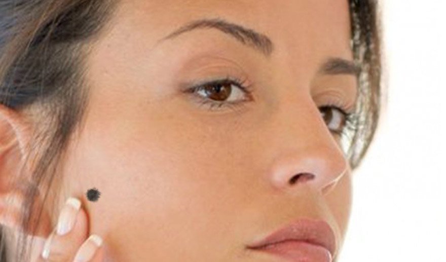 Benlerdeki renk, boyut, şekil değişikliklerine dikkat!..